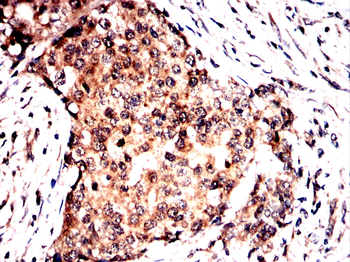 PVALB Antibody