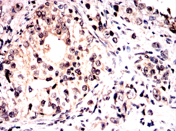 PVALB Antibody
