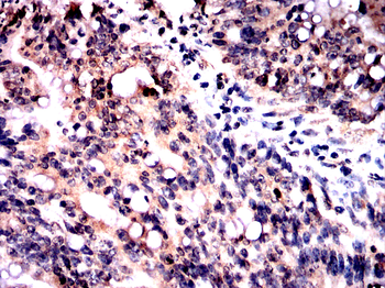 PVALB Antibody