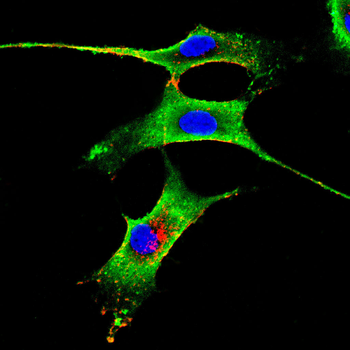 PVALB Antibody