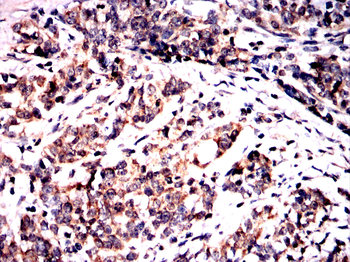 PVALB Antibody