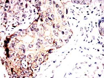 PVALB Antibody