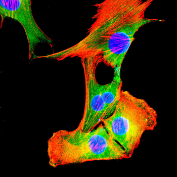 TET2 Antibody