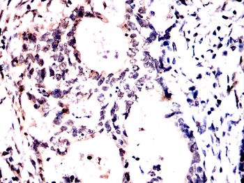 TET2 Antibody