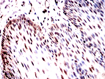 TET2 Antibody