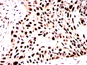 TET2 Antibody