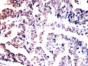 TET2 Antibody