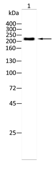 TET2 Antibody