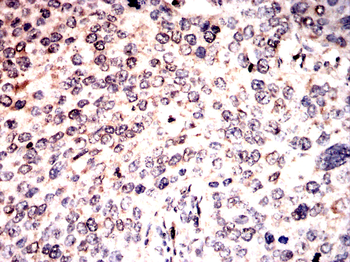 TEAD1 Antibody