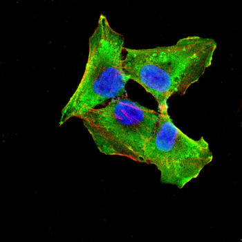 LAMC2 Antibody