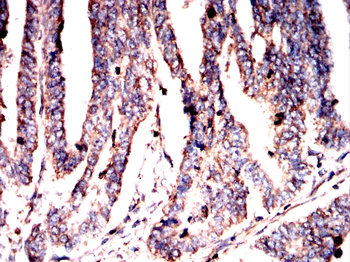 LAMC2 Antibody