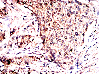 LAMC2 Antibody