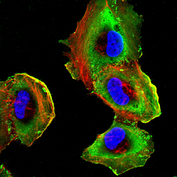 TLR1 Antibody