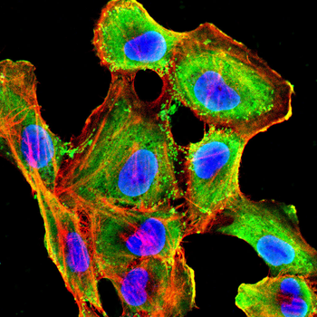 CLDN18 Antibody