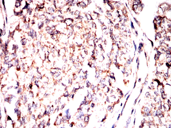 CLDN18 Antibody