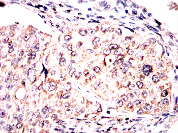 CLDN18 Antibody