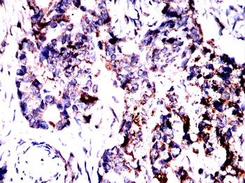 CLDN18 Antibody