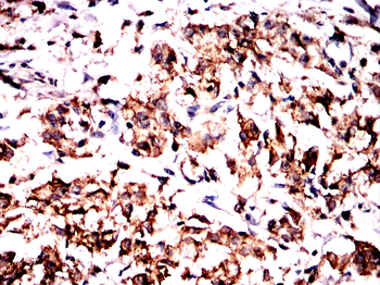 CLDN18 Antibody