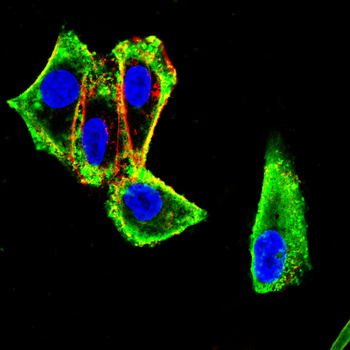 CLDN18 Antibody