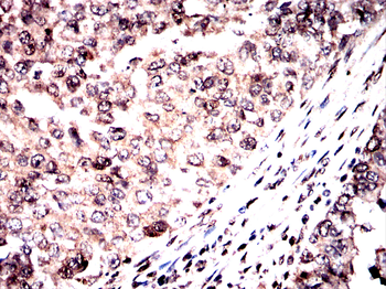 Myc tag antibody