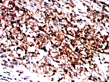 Myc tag antibody