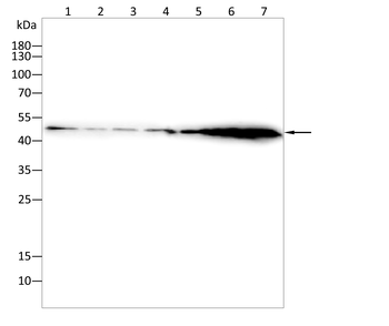 TUBB Antibody