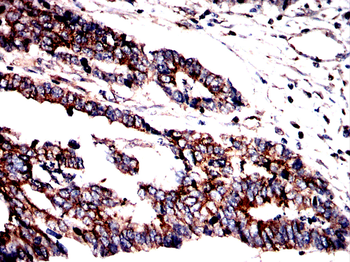 TUBB Antibody