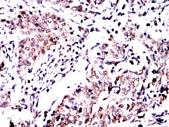 BCL2 Antibody