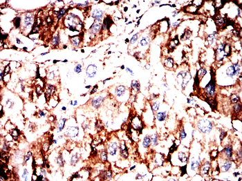 AKT1 Antibody