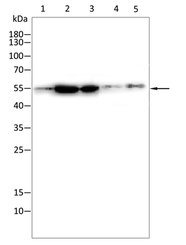 AKT1 Antibody