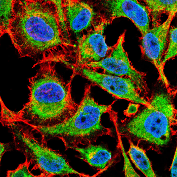 RELA Antibody