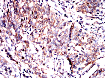 RELA Antibody