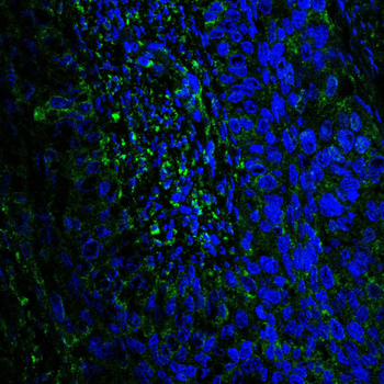 RELA Antibody