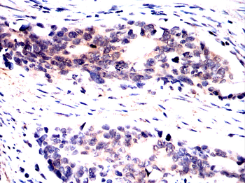 RELA Antibody