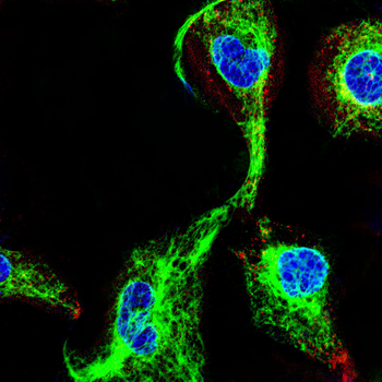 VIM Antibody