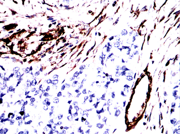 VIM Antibody