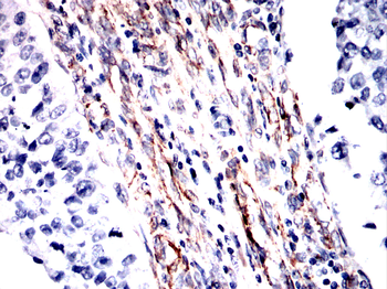 VIM Antibody