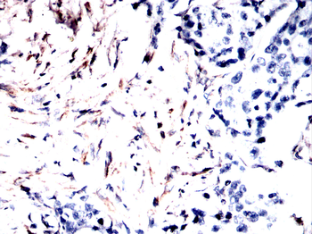 VIM Antibody