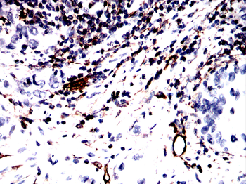 VIM Antibody