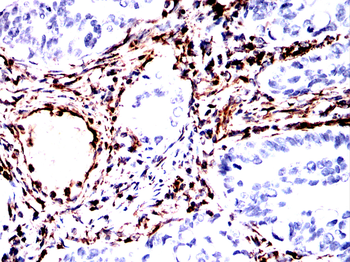 VIM Antibody