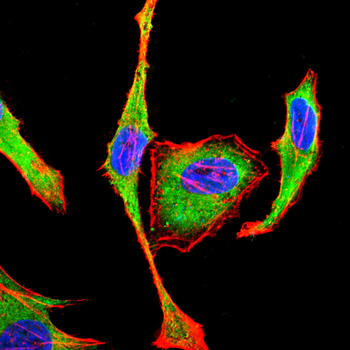 TP53 Antibody
