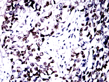 TP53 Antibody