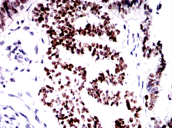 TP53 Antibody
