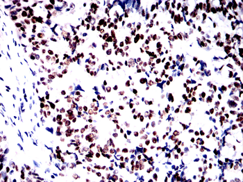 TP53 Antibody