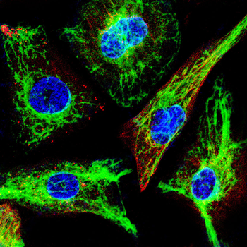 PARP Antibody