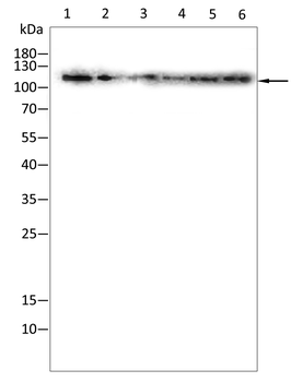 PARP Antibody