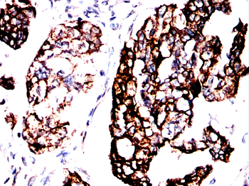KRT8 Antibody