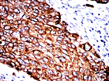 KRT8 Antibody