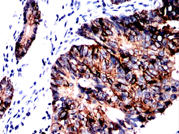 KRT8 Antibody