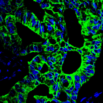 KRT8 Antibody